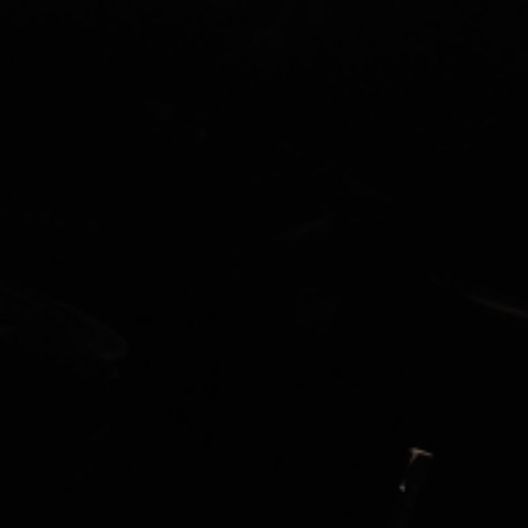 666磕到甲沟炎_788