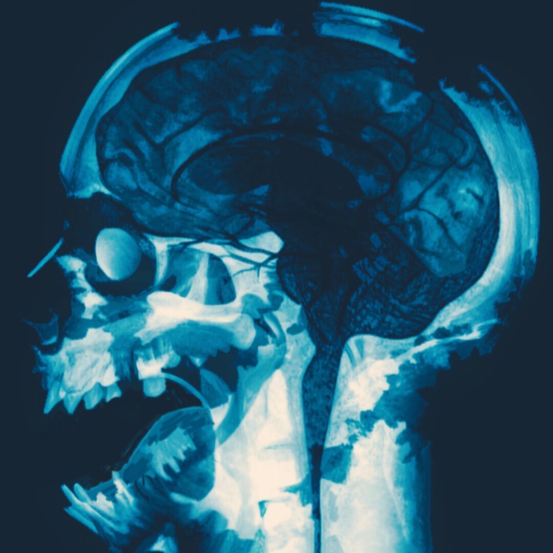 正在打僵尸的Zcom